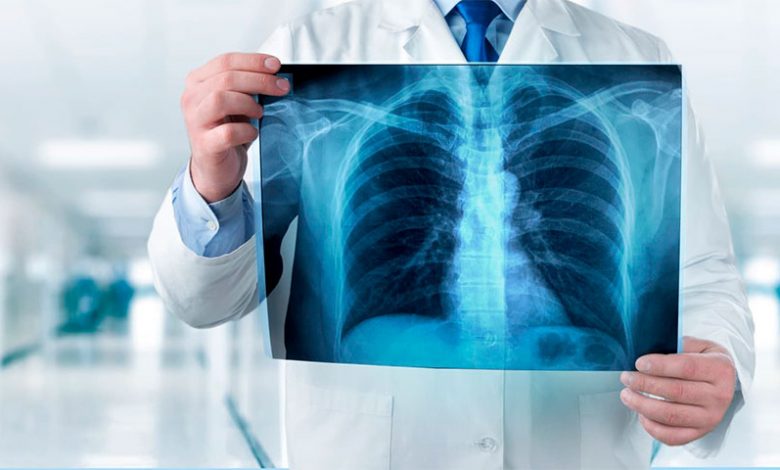 20 حقیقت جالب و خواندنی در مورد اشعه ایکس