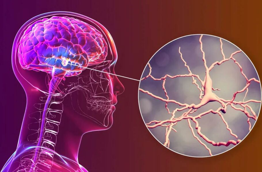 امیدی تازه برای درمان پارکینسون؛ سلول‌های کشت‌شده در آزمایشگاه جایگزین سلول‌های بیمار می‌شوند
