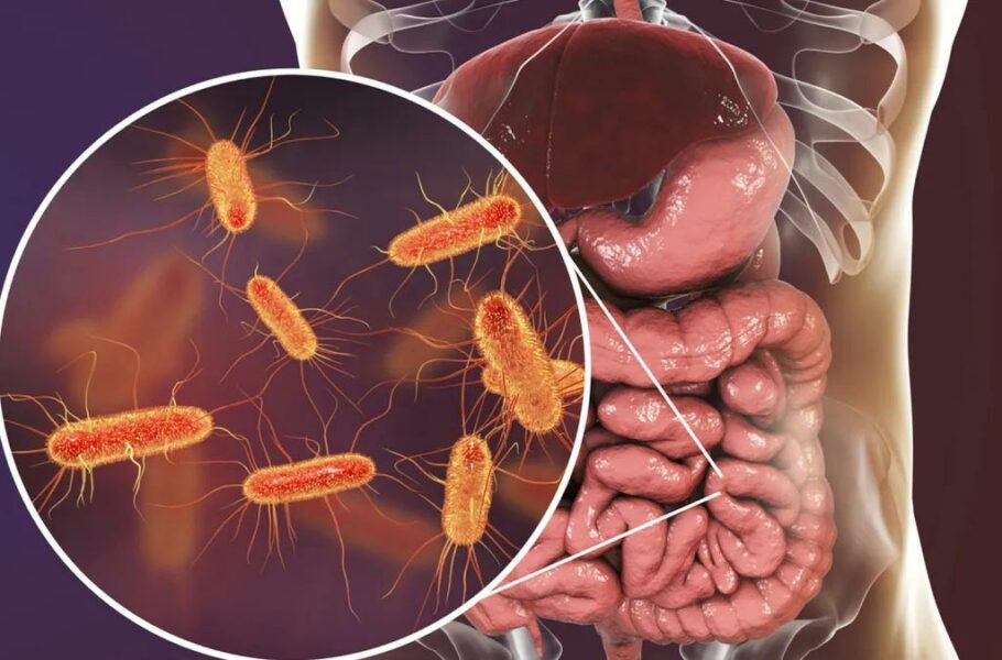 FDA آمریکا برای اولین‌بار به درمانی برای کاشت مدفوع در بدن مجوز داد