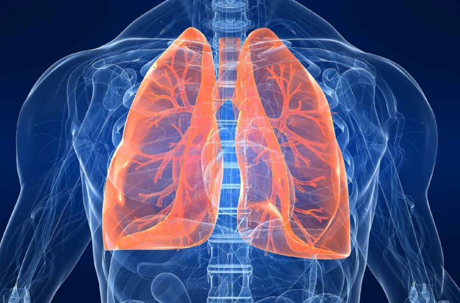 این هوش مصنوعی می‌تواند ابتلا به سرطان ریه را چندین سال زودتر پیش‌بینی کند