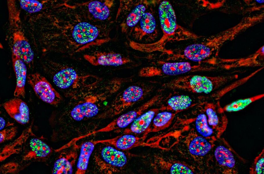 در مسیر درمان سرطان؛ کشف ماده‌ای که شبیه شخصیت منفی فیلم‌های جیمز باند عمل می‌کند