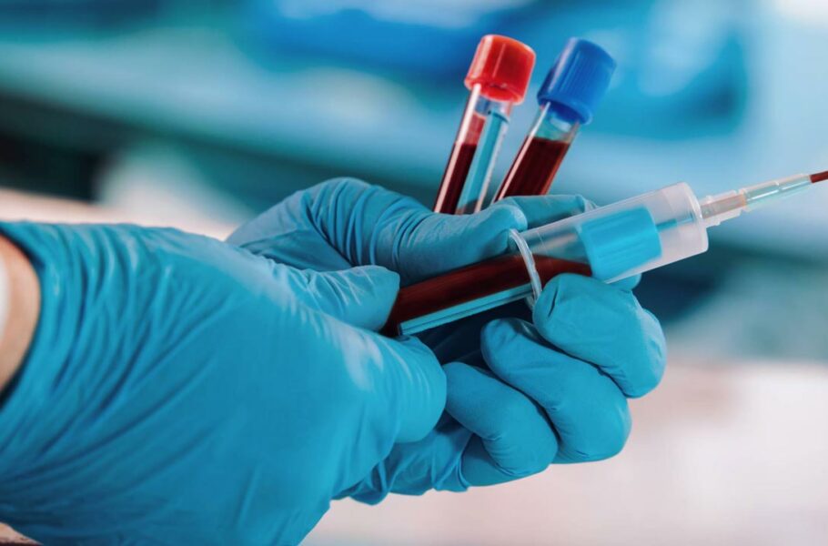 دستاوردی به رهبری دانشمند ایرانی: ساخت دستگاهی که تشخیص زودهنگام سرطان از روی خون را ممکن می‌کند