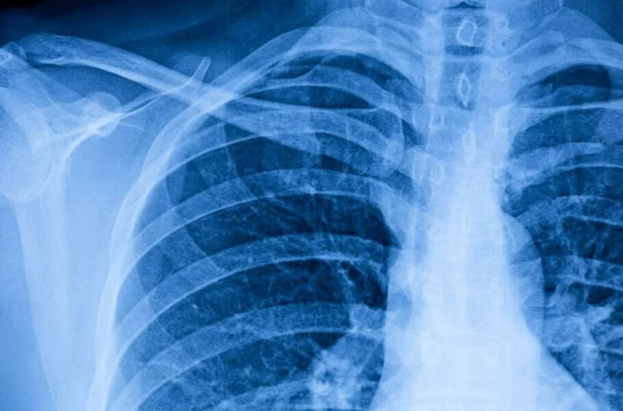 این ابزار هوش مصنوعی جدید می‌تواند ناهنجاری‌های قفسه سینه بیماران را تشخیص دهد