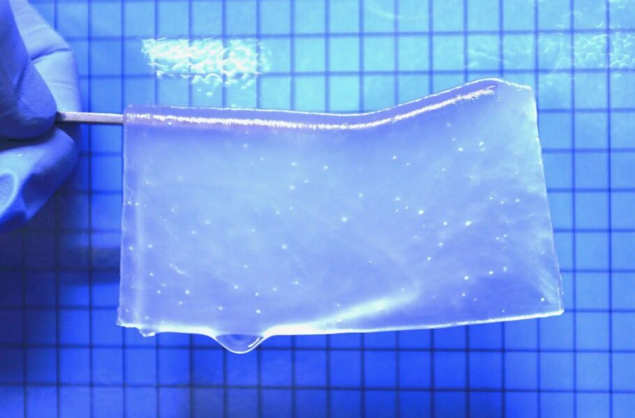 دانشمندان با ساخت نوعی هیدروژل به دنبال بهبود آسیب‌های مغزی هستند