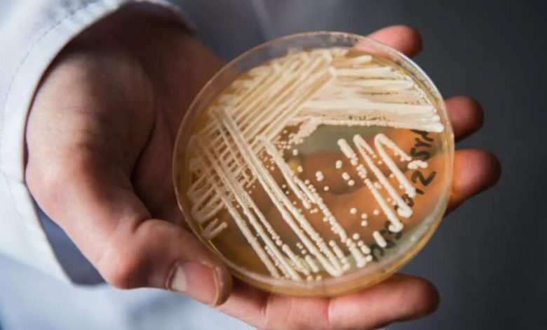 گسترش یک بیماری قارچی کشنده در آمریکا؛ محققان نگران مقاومت بیماری به داروها هستند
