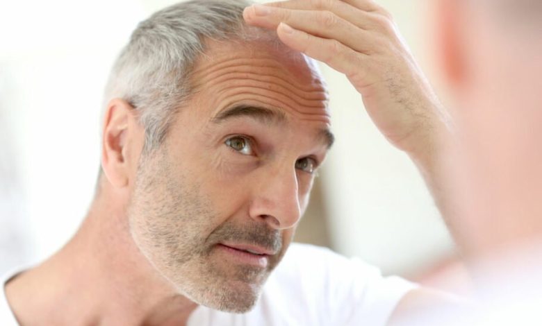 دانشمندان به راهکار احتمالی جدیدی برای جلوگیری از سفید شدن مو دست یافتند