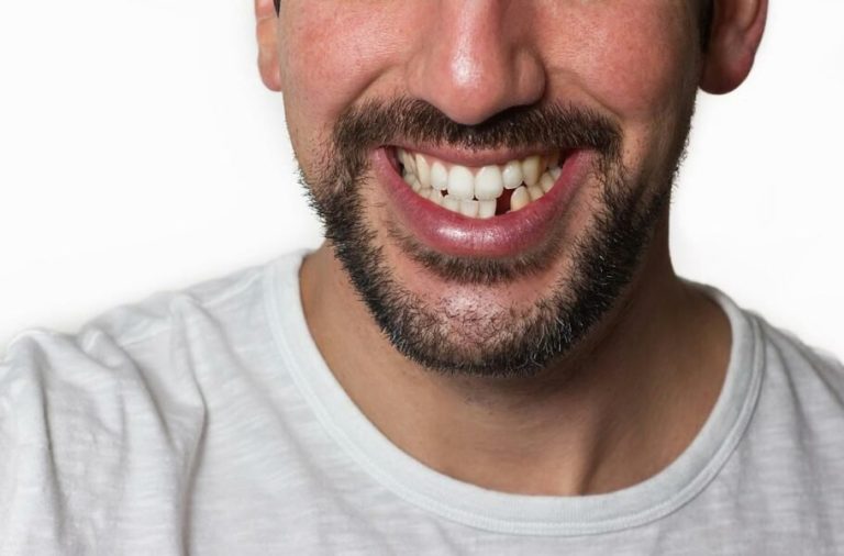 تحولی در دنیای دندان‌پزشکی؛ توسعه دارویی که احتمالاً موجب رشد مجدد دندان‌ها می‌شود