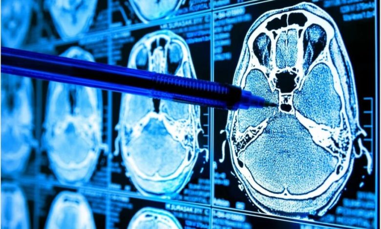 توسعه هوش مصنوعی جدیدی که می‌تواند نشانه‌های بیماری را در اسکن‌های MRI پیدا کند