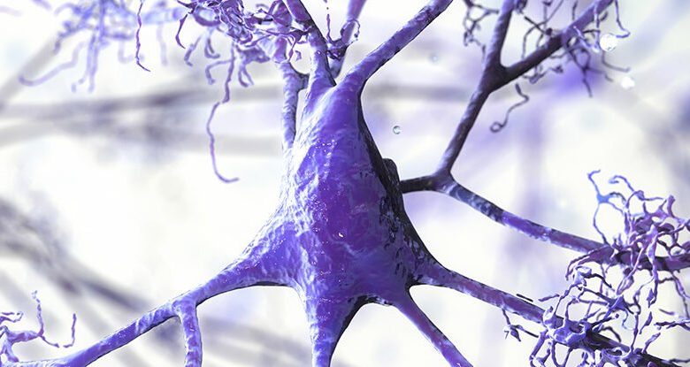 مطالعه جدید: علت جدید آلزایمر در ماده سفید مغز ما کشف شد