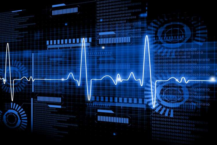 هوش مصنوعی و تحول در تشخیص بیماری‌های قلبی: نوآوری‌های جدید در تحلیل نوار قلب (ECG)