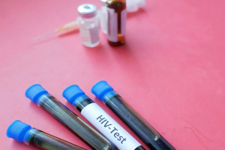 داروی پیشگیری از ایدز از دو سال دیگر عرضه میشود