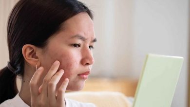 رازهای پنهان مراقبت از پوست: ۵ عادت ساده برای پیشگیری و درمان جوش