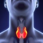 درمان سرطان تیروئید: از تشخیص زودهنگام تا رویکردهای کمتهاجمی نوین